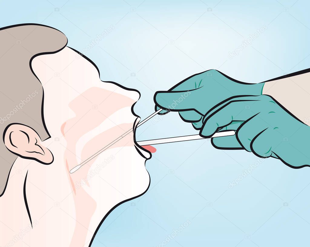 step 4 : For throat swab, take a second dry polyester swab, insert into mouth, and swab the posterior pharynx and tonsillar areas. (Avoid the tongue).