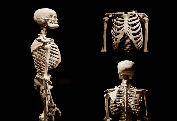 Ανθρώπινος Σκελετός Ανατομικός Θάνατος Αφηρημένα Ισοπεδωμένος — Φωτογραφία Αρχείου