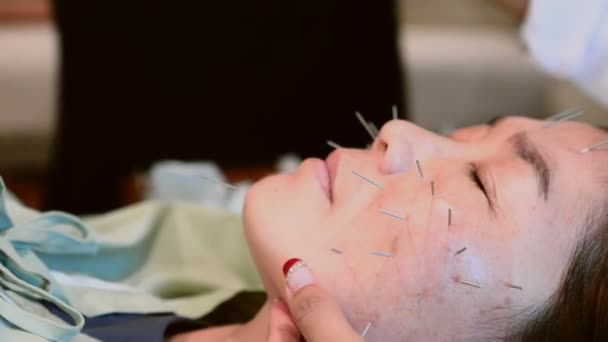亚洲女子针灸美容面部护理 — 图库视频影像