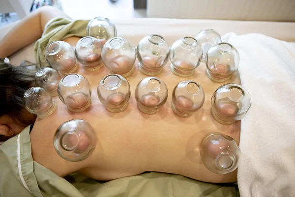 patience undergoing of chinese cupping therapy