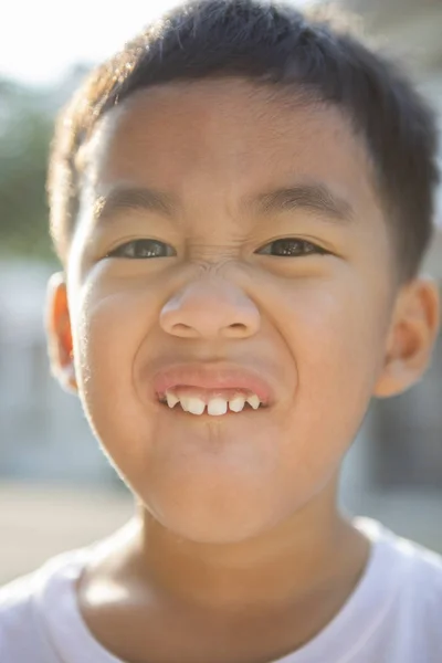 Close up face of asian children showing milk tooth — Stock Photo, Image