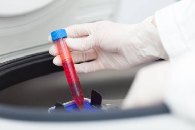 Bir doktor bir laboratuvar santrifüj kullanarak detay