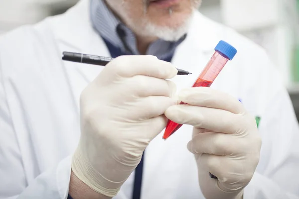 Cientista Escrevendo Tubo Teste Que Contém Sangue Seu Laboratório — Fotografia de Stock