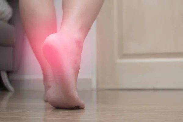 女性の右足のかかとの痛みと赤いスポット 足底筋膜炎のクローズ アップ — ストック写真