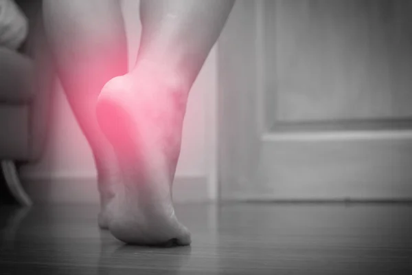 Zbliżenie Bólu Pięty Prawej Stopy Kobiece Czerwonych Spot Plantar Fasciitis — Zdjęcie stockowe