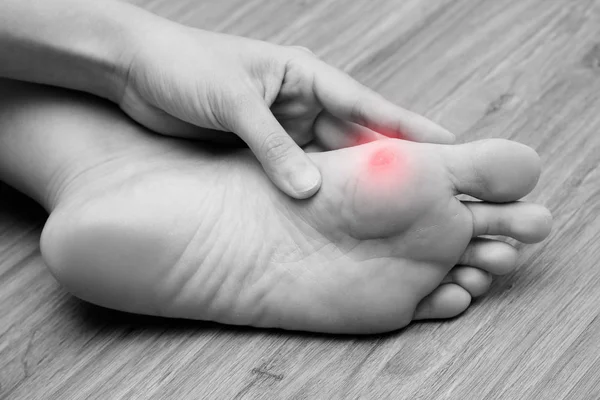 A woman suffering from corn on her foot sole. Black and white tone with red spot on her corn