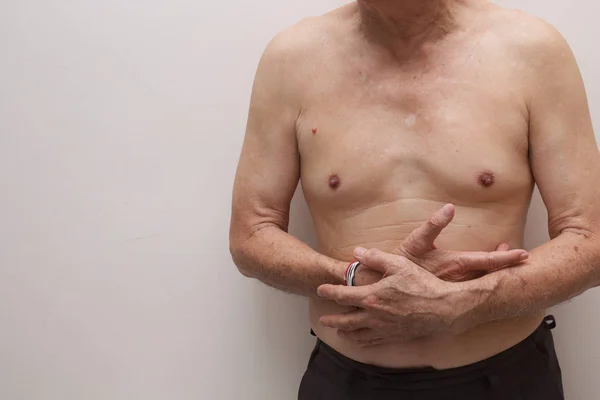 Uomo Anziano Con Dolore Addominale Mal Stomaco Crampi Mestruali — Foto Stock