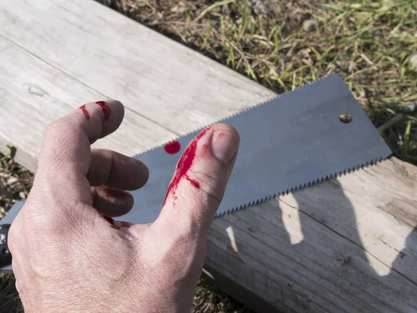 Bleeding fingers after an accident with a wood saw.