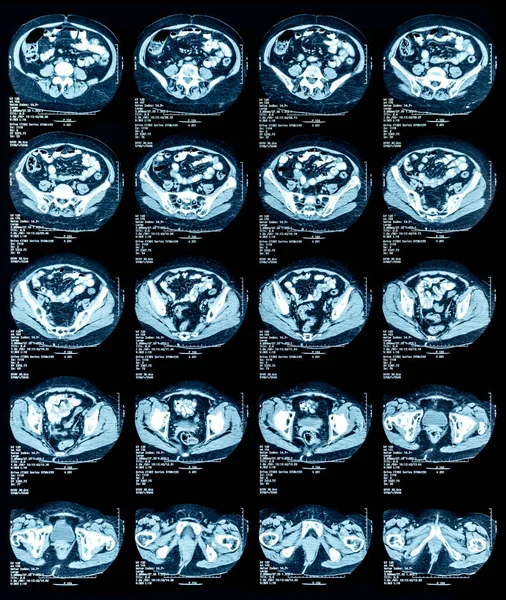 Obraz Rezonansu Magnetycznego Mri Klatki Piersiowej Brzucha — Zdjęcie stockowe