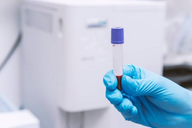 Bir laboratuvar teknisyeninin ellerinde bir tüp kan örneği ve diğer örneklerle dolu bir raf var. Laboratuvar teknisyeninin elinde çalışma için kan tüpü örneği var. Corona virüsü salgını konsepti..