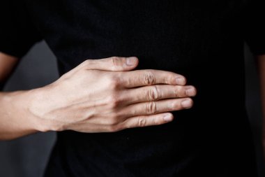 vitiligo ile bir elin yakın çekim