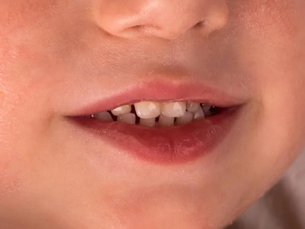 Sorriso Bebê Close Dentes Cama Macro — Fotografia de Stock