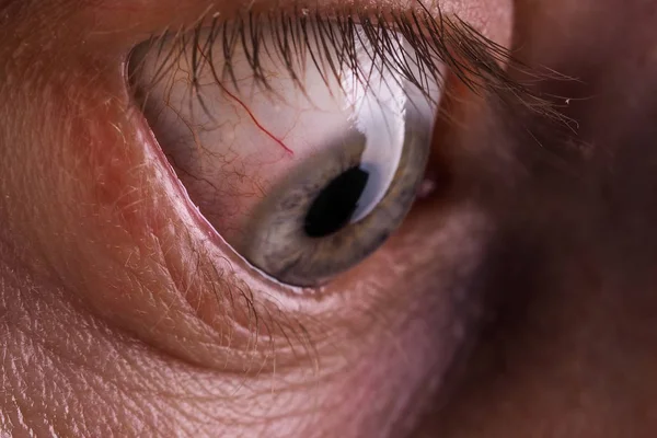 Κόκκινων Ματιών Ενός Ανθρώπου — Φωτογραφία Αρχείου