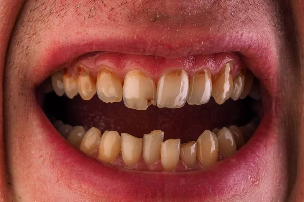 Tandheelkundige geneeskunde en gezondheidszorg-menselijke patiënt open mond ler — Stockfoto