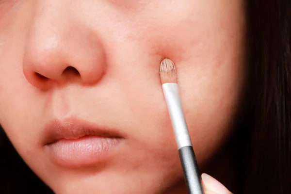 Problema de la piel del acné, Primer plano de la mujer asiática aplicación de corrector hacer — Foto de Stock