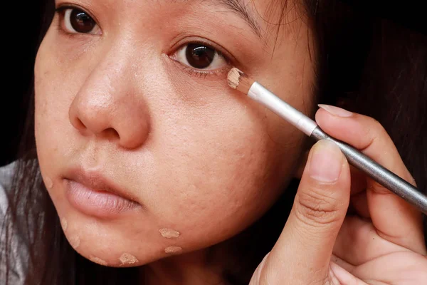 Akne Hautproblem, Nahaufnahme von asiatischen Frau Anwendung Concealer Make — Stockfoto