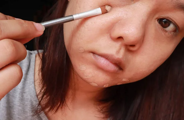 Acne problema de pele, Closeup de mulher asiática aplicando corretor fazer — Fotografia de Stock