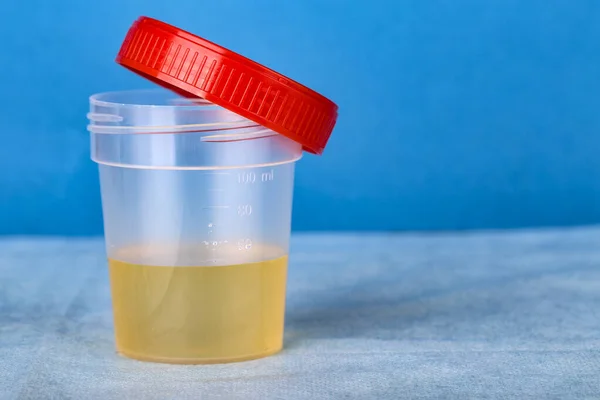 Nuovo contenitore di plastica con analisi delle urine — Foto Stock
