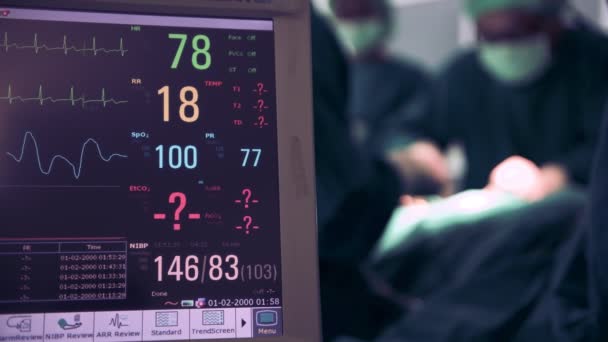 Vital Monitoring Display Operating Theater Surgeon Background — Stock Video