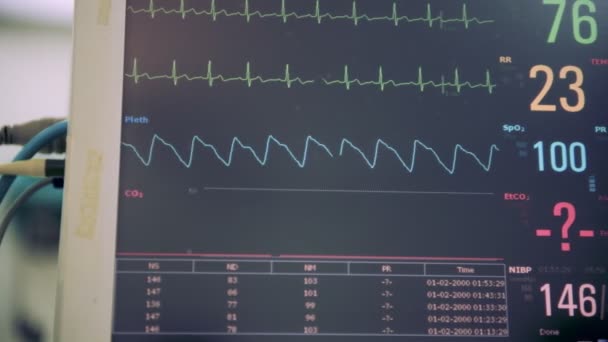 Visualizzazione Del Monitoraggio Vitale Sala Operatoria Con Chirurgo Sullo Sfondo — Video Stock