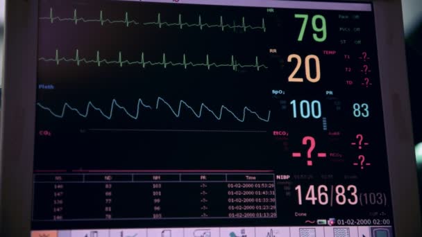 Vital Övervakning Display Rörelsens Theater Med Kirurgen Bakgrunden — Stockvideo