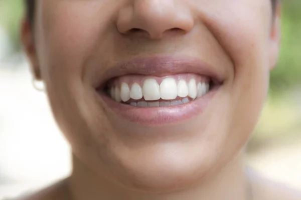 近距离观察牙齿快乐的女性微笑 免版税图库图片