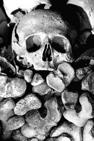 那不勒斯卫生区 德尔奇米泰罗阿囟门 的头骨 — 图库照片