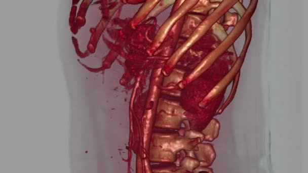 Reconstruction Kidneys Surrounding Structures — Stock Video