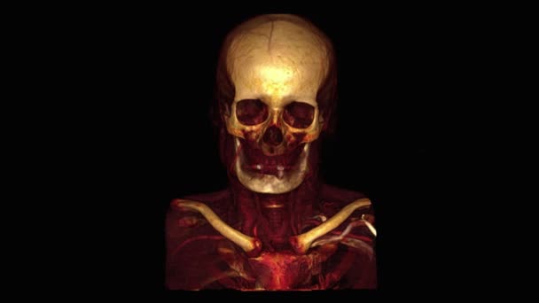 Escaneo Cráneo Humano — Vídeo de stock