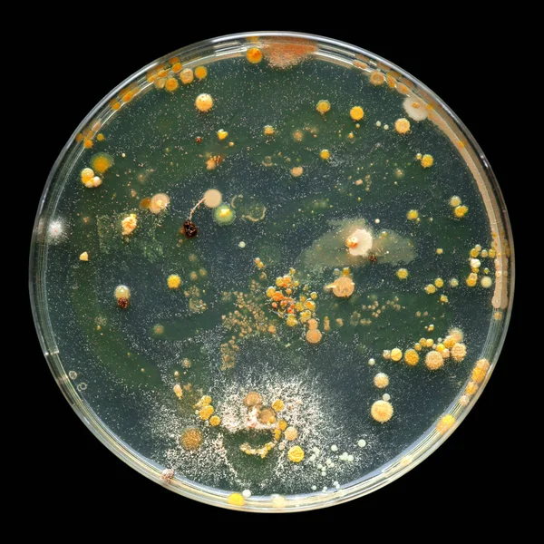 Petri dish growing bacteria