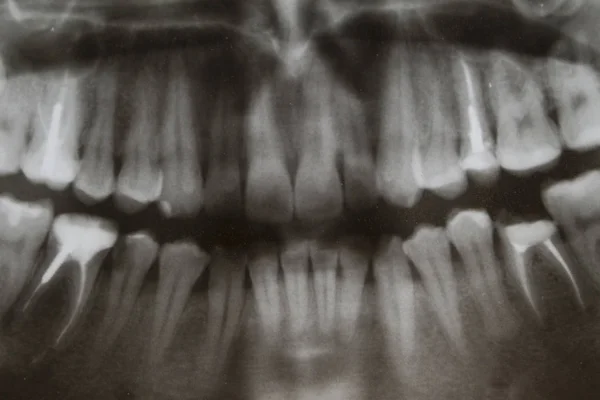 Para Estudiar Una Radiografía Dientes — Foto de Stock