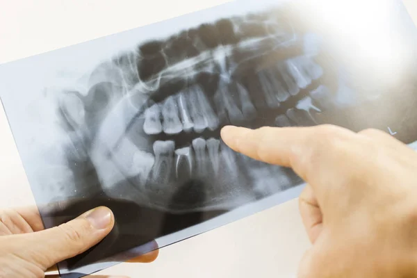 Para Estudiar Una Radiografía Dientes — Foto de Stock