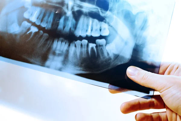 Para Estudiar Una Radiografía Dientes Tonificada — Foto de Stock