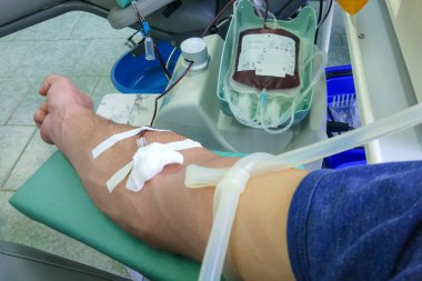 bir erkek donör 's el Close-Up