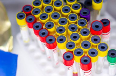 Yeni tıbbi test tüpünün yakın çekimi..