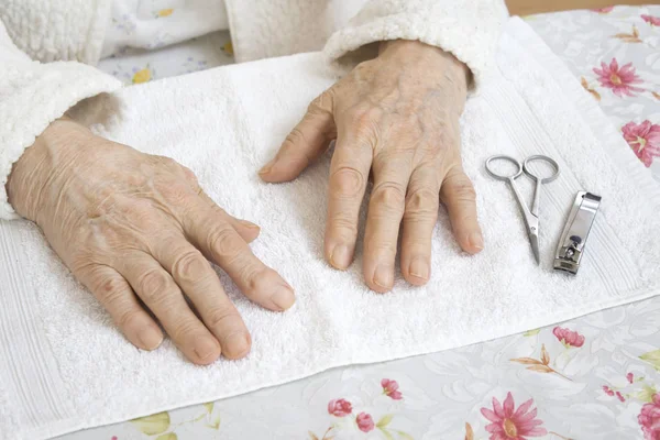 Mãos Uma Velha Mulher Preparada Para Tratamento Cosmético — Fotografia de Stock