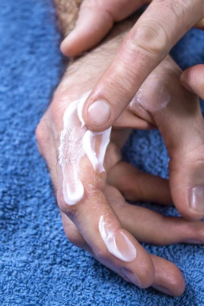 Schmierung Mit Salbe Der Schuppenflechte Leidenden Hand — Stockfoto