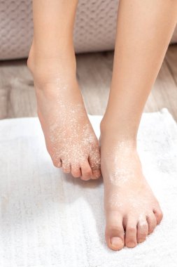 Çocuk cilt hastalığı. Beyaz toz lama çocuğun ayağında yatıyor.