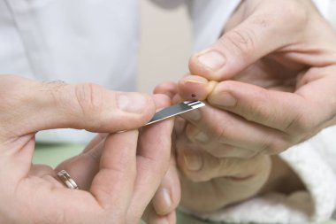 Metre bir kağıt ile bir doktorun elleri kan damlası ile bir parmak koymak.