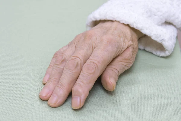 Cuero Viejo Dañado Mano Una Mujer Muy Anciana Albornoz Blanco — Foto de Stock