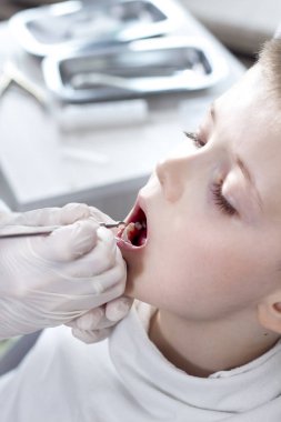 Beyaz önlüklü ve tek kullanımlık eldivenli doktor okul çağındaki çocuğun dişlerinikontrol ediyor..