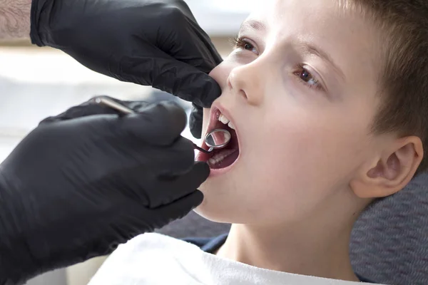 Dentist\'s hands in disposable black rubber gloves hold a dental mirror. The school-age boy sits on a chair with an open mouth. The doctor is watching the boy\'s teeth.