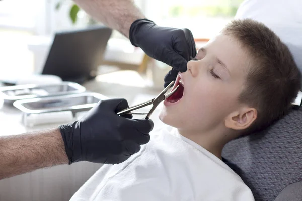 Las Manos Del Dentista Guantes Goma Negro Sostienen Pinzas Para —  Fotos de Stock