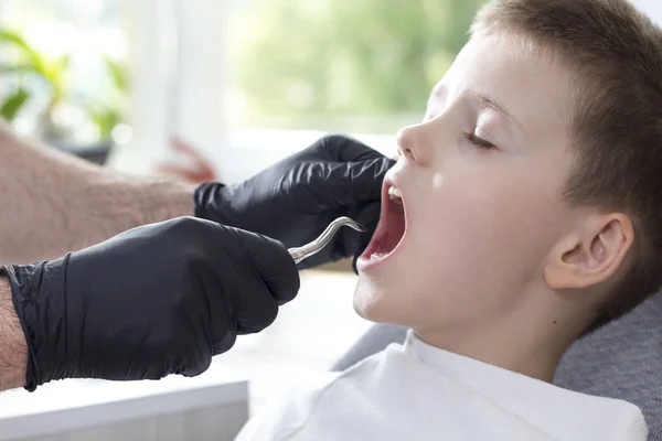 拔掉一颗牛奶牙 这个男孩正坐在牙科椅上 戴黑色橡胶手套的牙医拿着侧根杆 — 图库照片