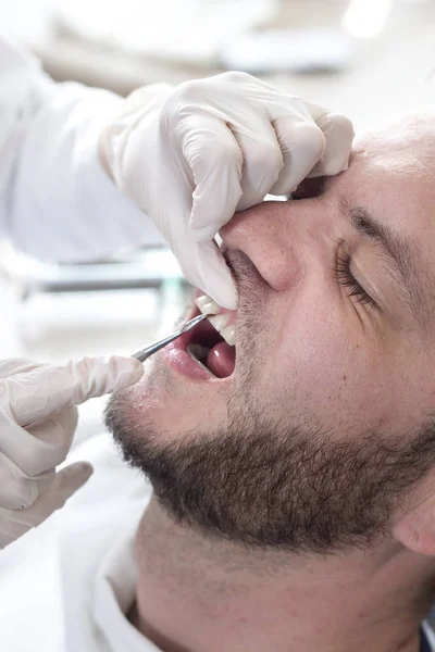 The tip of the excavator touches the gap between the teeth during dental inspection. The face of a white man with light stubble lies on the chair during the examination.
