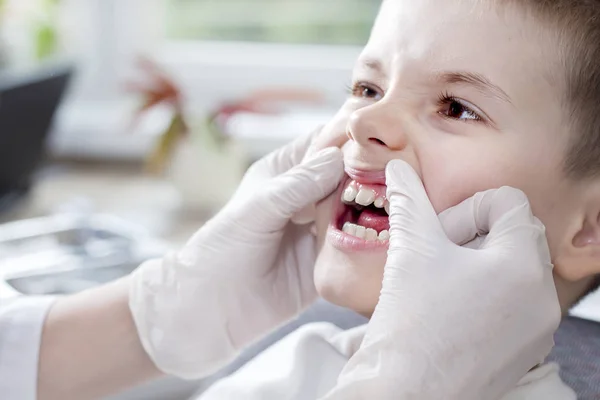 아이의 상태를 확인합니다 장갑을 의사의 잇몸을 움직이고 소년의 이빨을 드러낸다 — 스톡 사진
