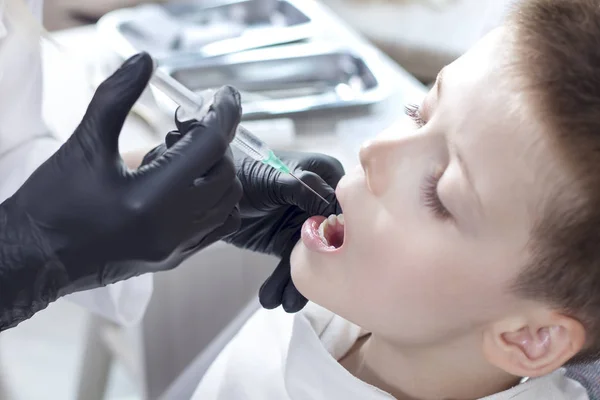 Tandarts Zwarte Rubberen Handschoenen Houdt Een Spuit Met Een Naald — Stockfoto