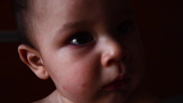 Extreme close up portrait shot of six months old baby with mosquito bites on face trying to reach camera — Stock Video