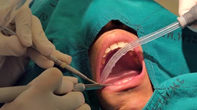 Profesyonel diş hekimi tedavi ve plak veya diş prosedürleri diş temizleme.