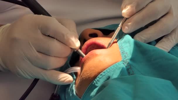 专业牙医治疗和清洁牙菌斑或牙科程序 — 图库视频影像